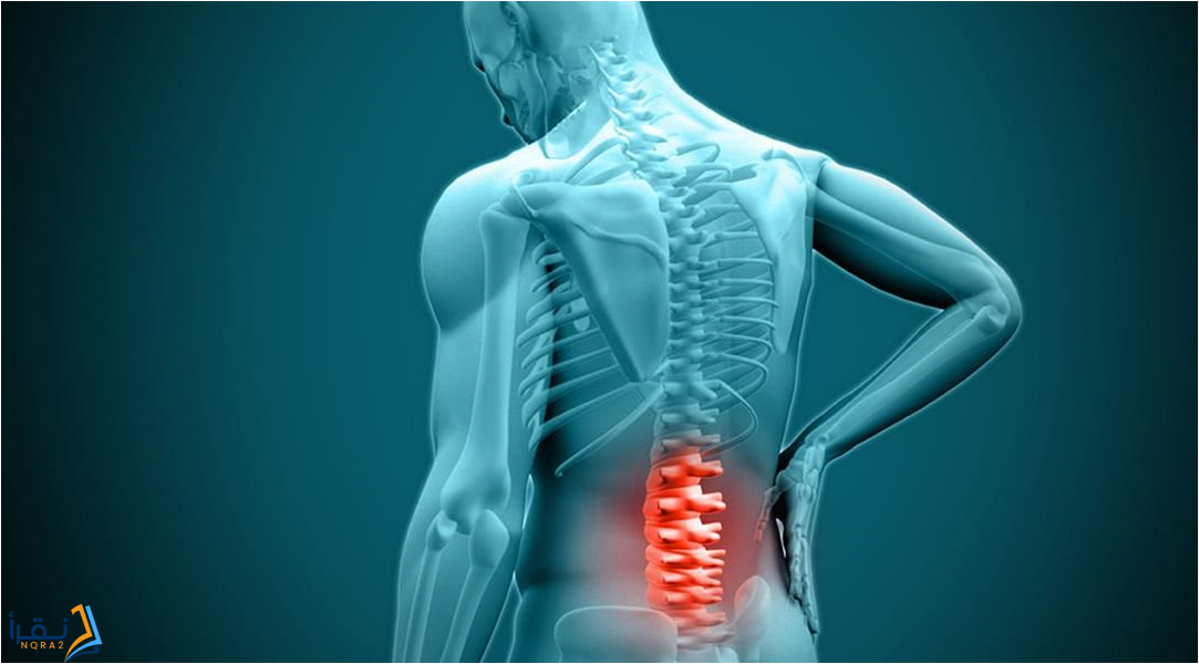 amicus-illustration-of-amicus-injury-anterior-disc-bulge-lumbar-l2-3