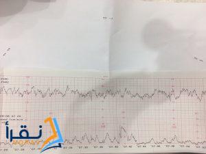 كيفية قراءة CTG